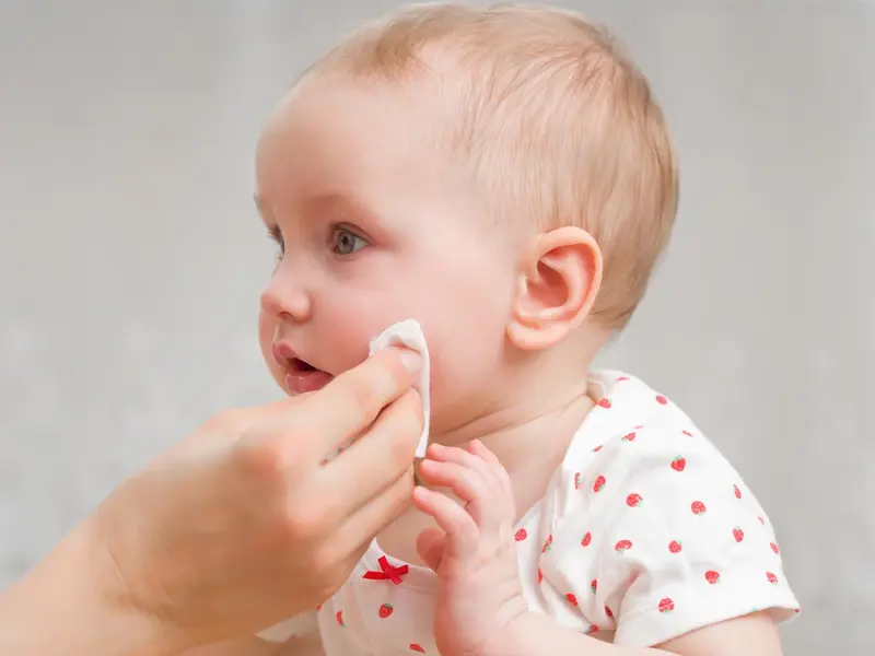 traiter les boutons de chaleurs chez Bébé